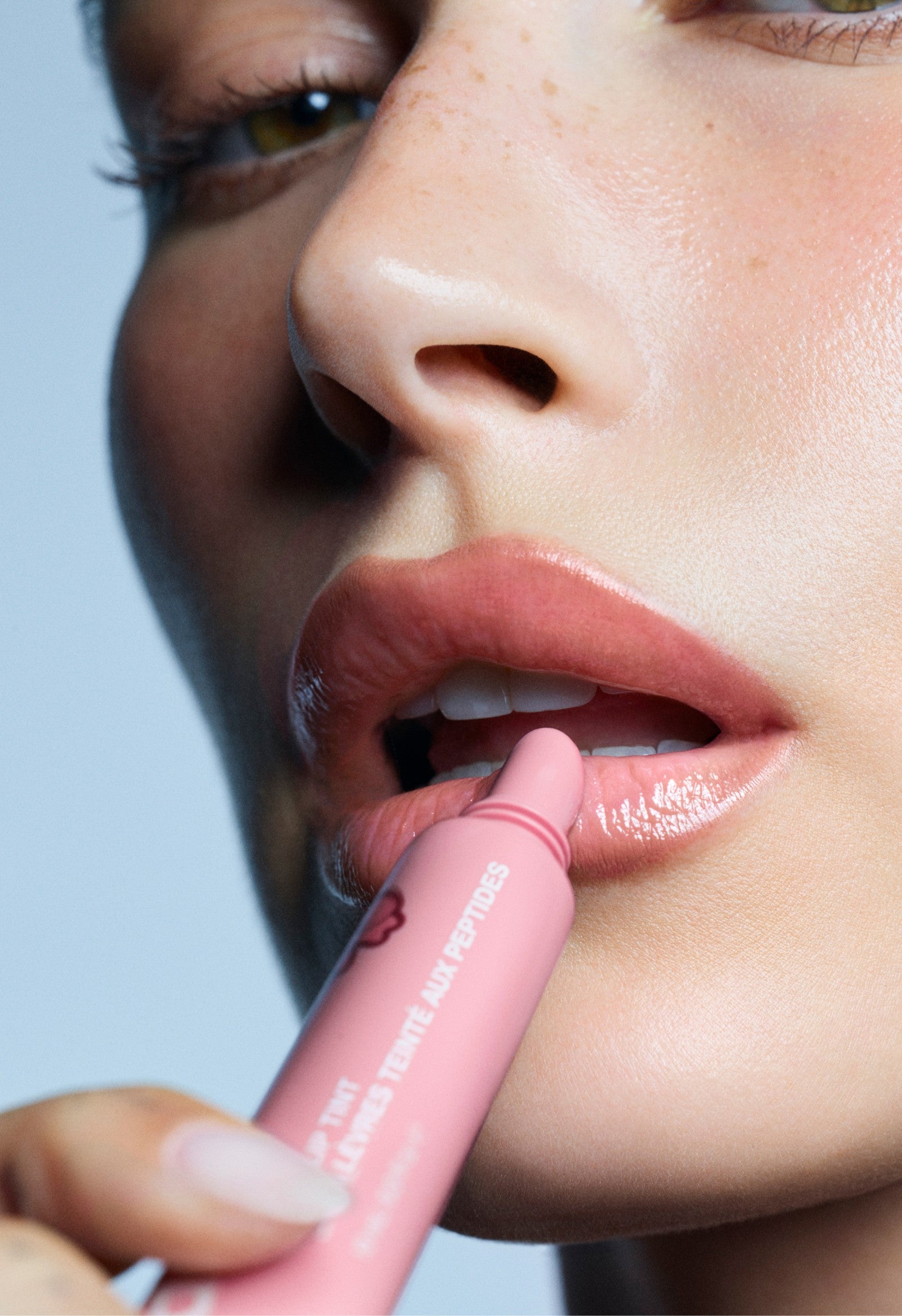 Alternative view of the winter kit